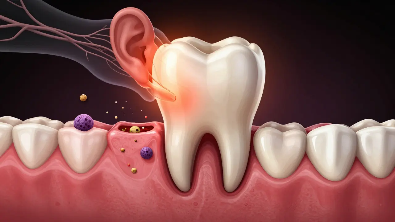 Částečně vyrůstající osmička v zánětlivé dásni s viditelnými bakteriemi a nervovými spojeními bolesti.